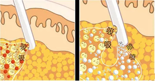水动力整形卡通示意图.jpg